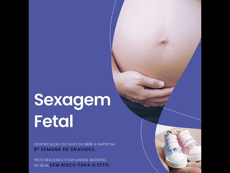 Sexagem fetal